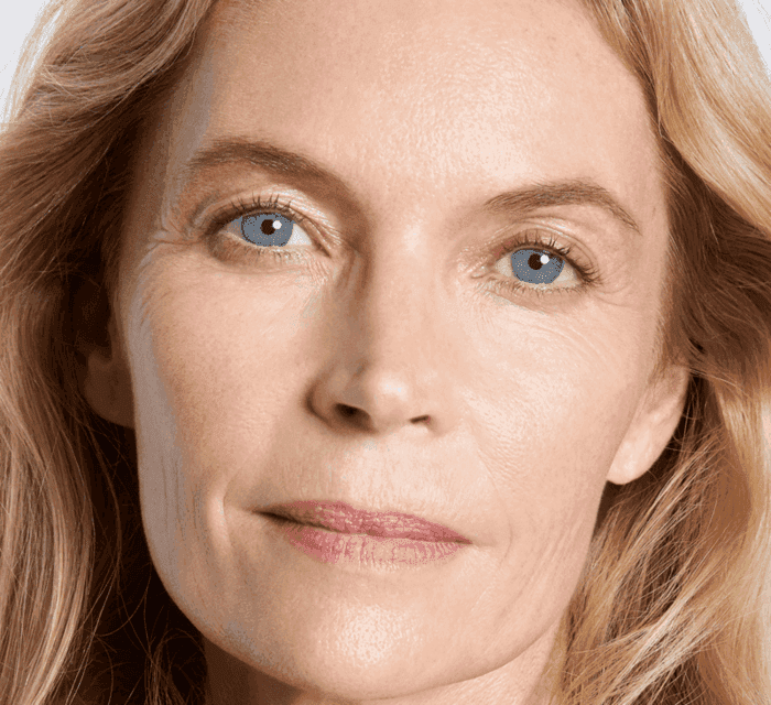 FACELIFT